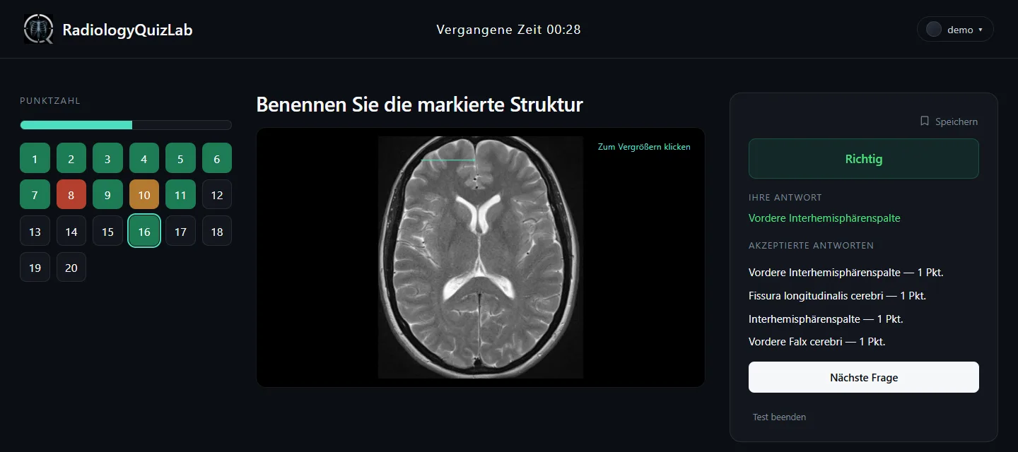 Die als richtig gewertete Antwort, mit allen akzeptierten Bezeichnungen und ihren Punkten.
