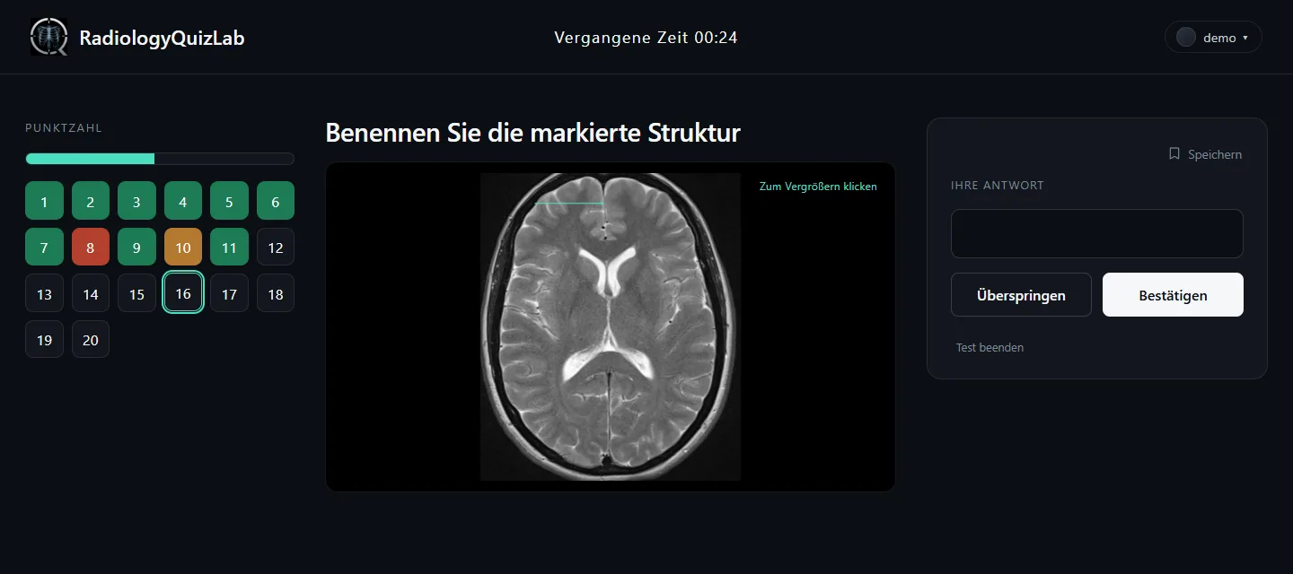 Eine laufende Frage: axiales T2-MRT des Gehirns mit mintfarbenem Pfeil und leerem Antwortfeld.