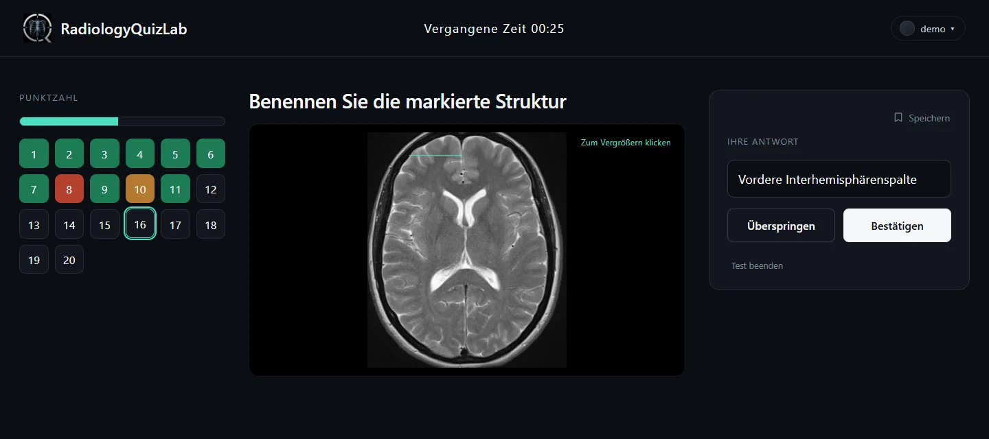 Dieselbe Frage mit einer eingetippten Antwort im Feld.