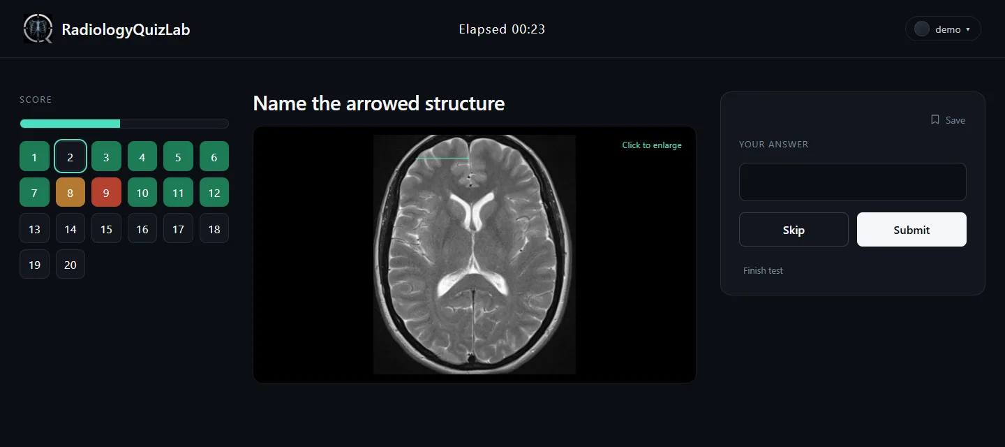 A question in progress: an axial T2 brain MRI with a mint arrow, and an empty answer box.