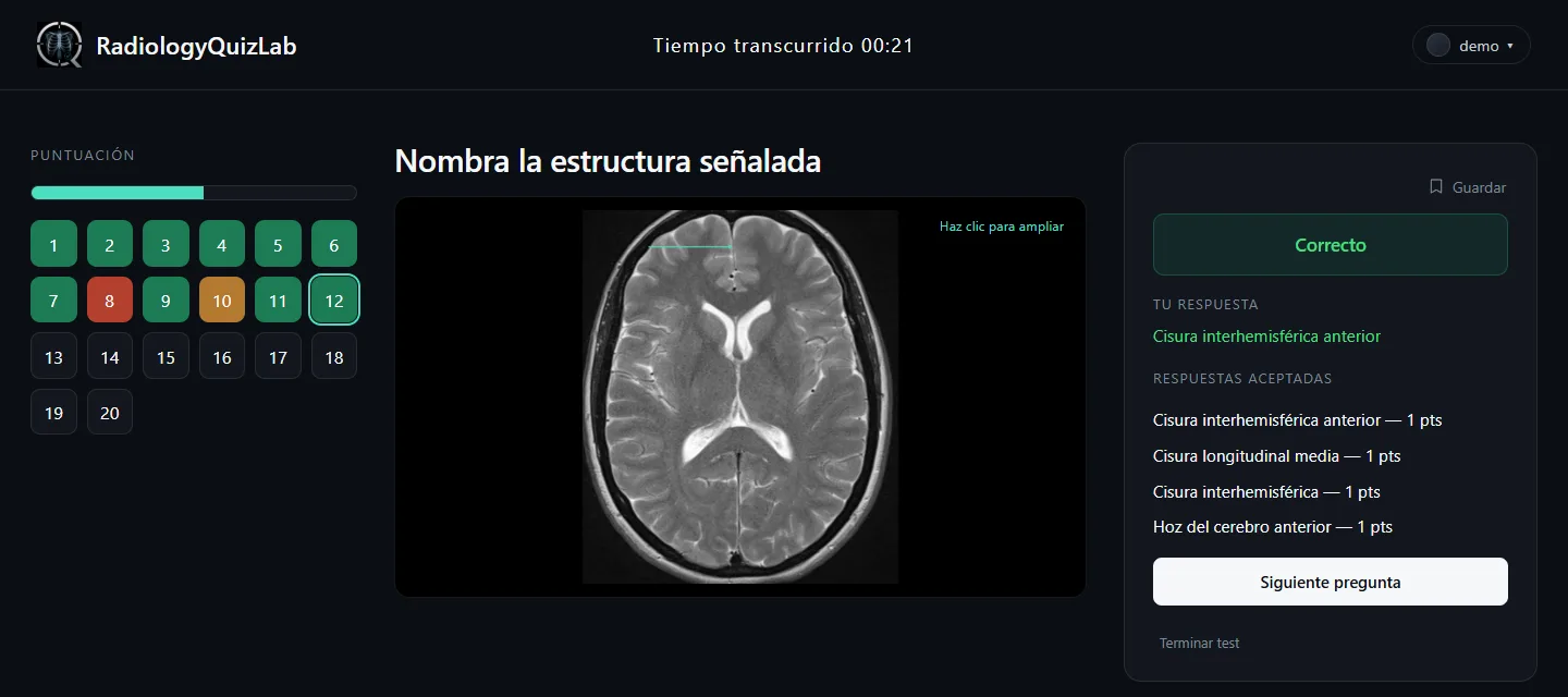 La respuesta marcada como correcta, con todas las formulaciones aceptadas y sus puntos.