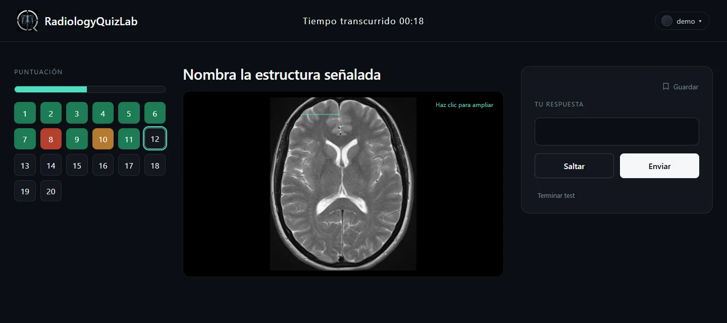 Una pregunta en curso: RM cerebral axial T2 con una flecha verde menta y un campo de respuesta vacío.