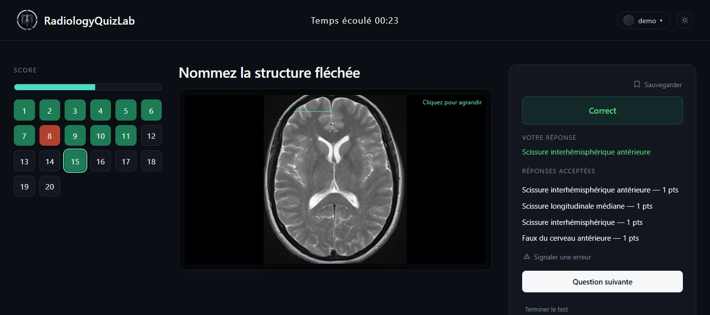 La réponse validée, avec toutes les formulations acceptées et leurs points.