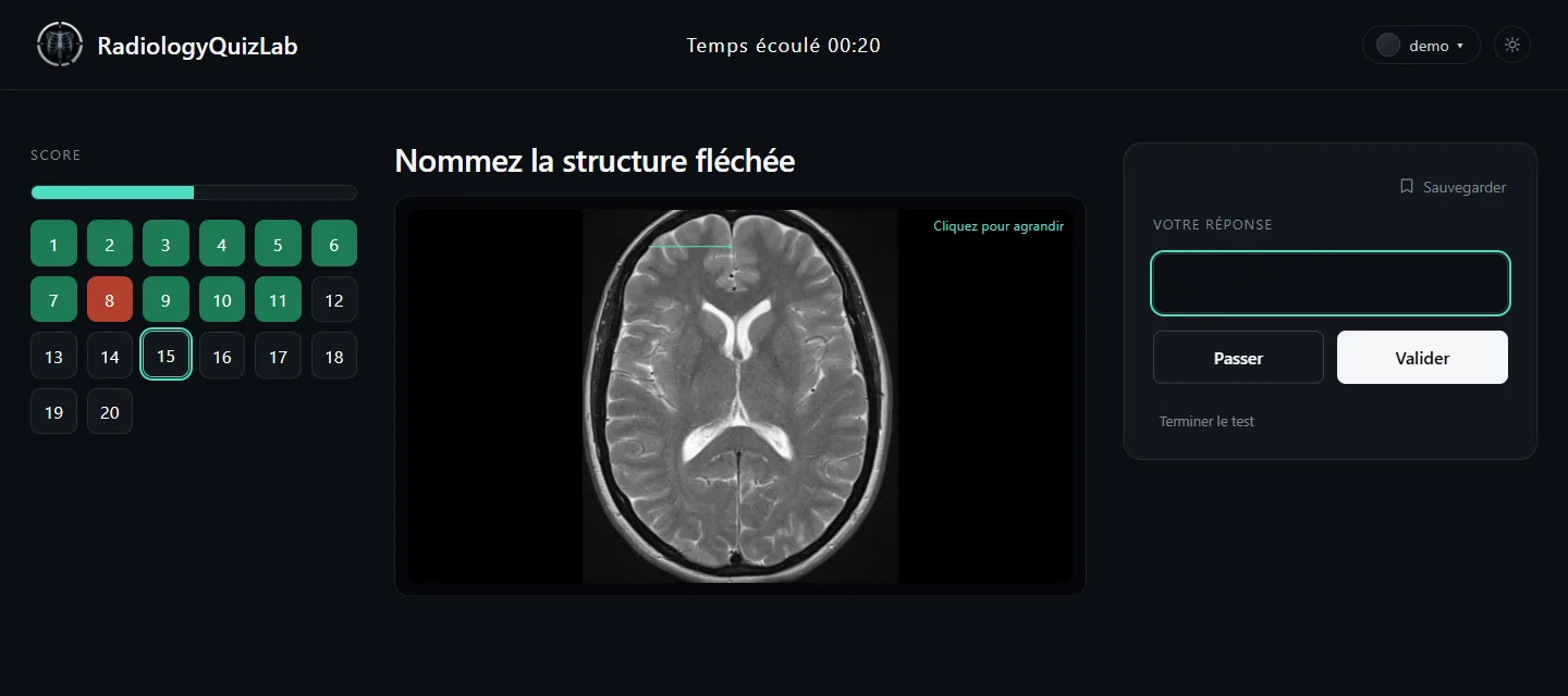 Une question en cours : IRM cérébrale axiale T2 avec une flèche menthe, et un champ de réponse vide.