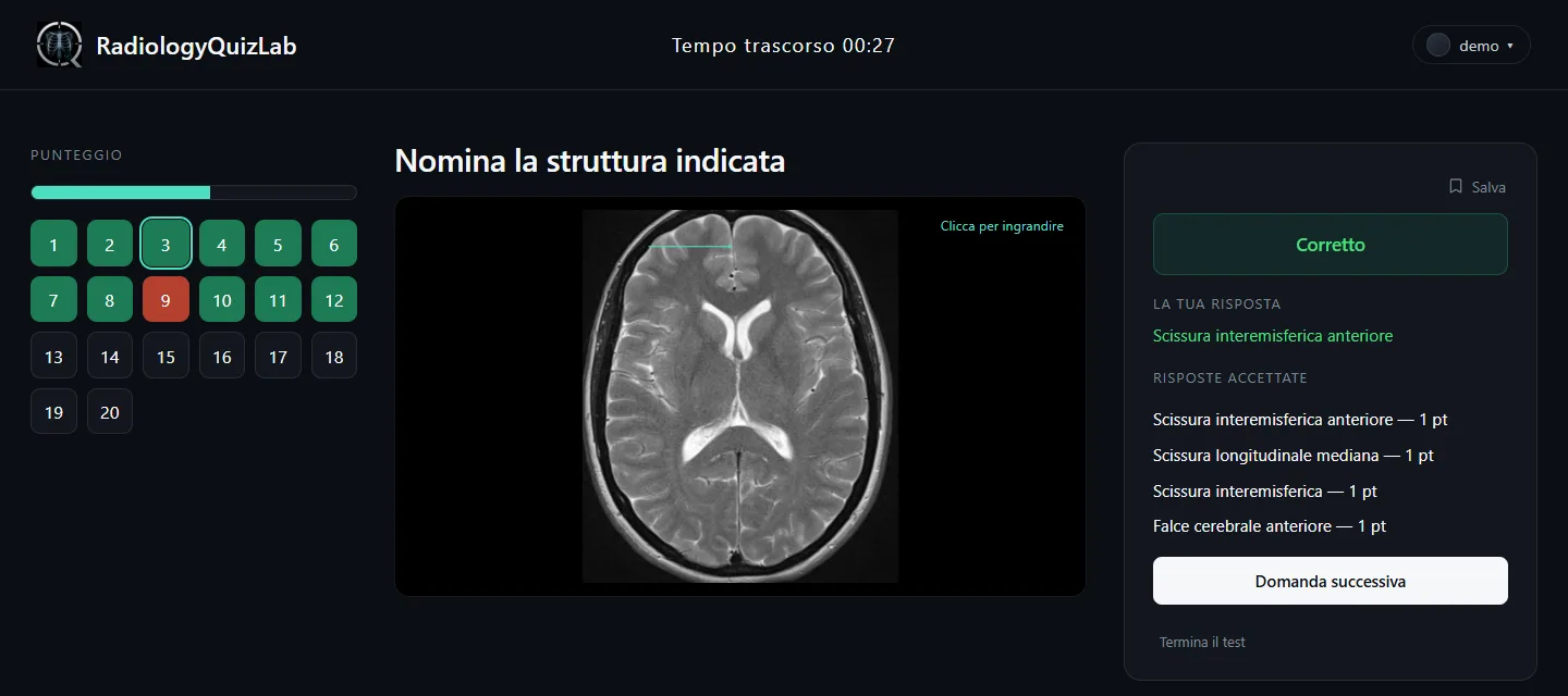 La risposta segnata come corretta, con tutte le formulazioni accettate e i relativi punti.