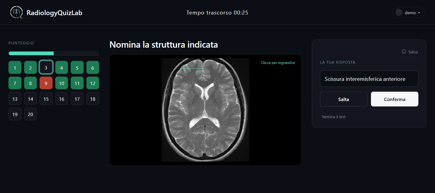La stessa domanda con una risposta digitata nel campo.