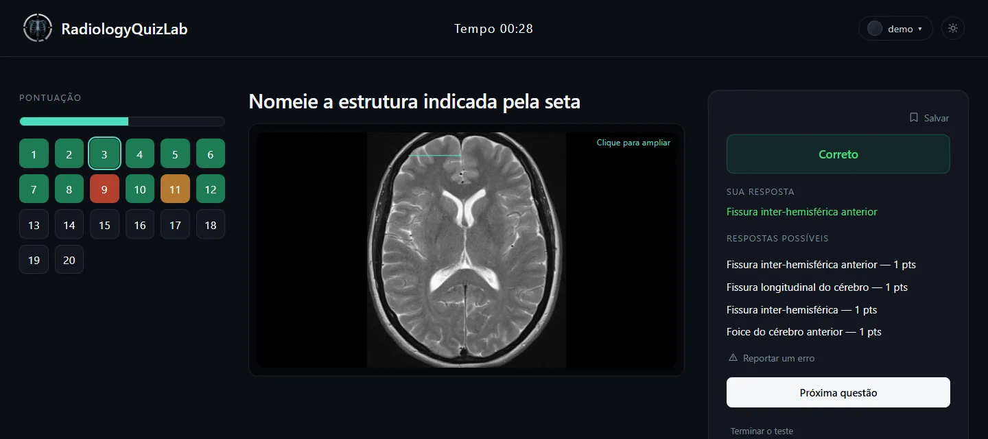 A resposta marcada como correta, listando todas as formulações aceitas e seus pontos.