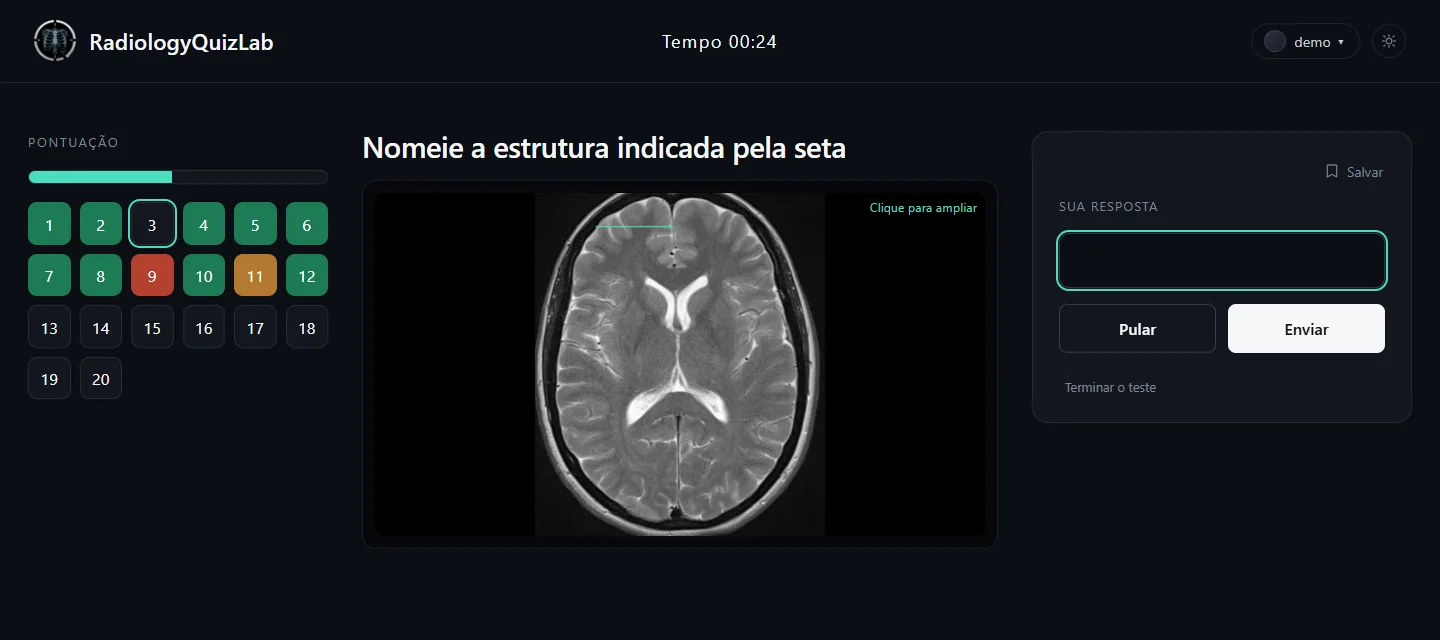 Uma questão em andamento: uma RM de crânio axial em T2 com uma seta verde-menta e um campo de resposta vazio.